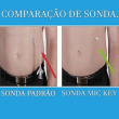 Sonda de Gastrostomia Botton MIC-KEY com Válvula Anti-Refluxo - Avanos