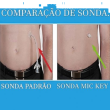 Sonda de Gastrostomia com Válvula anti-refluxo MIC-KEY 12 FR